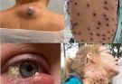 These are the signs that it’s gro…